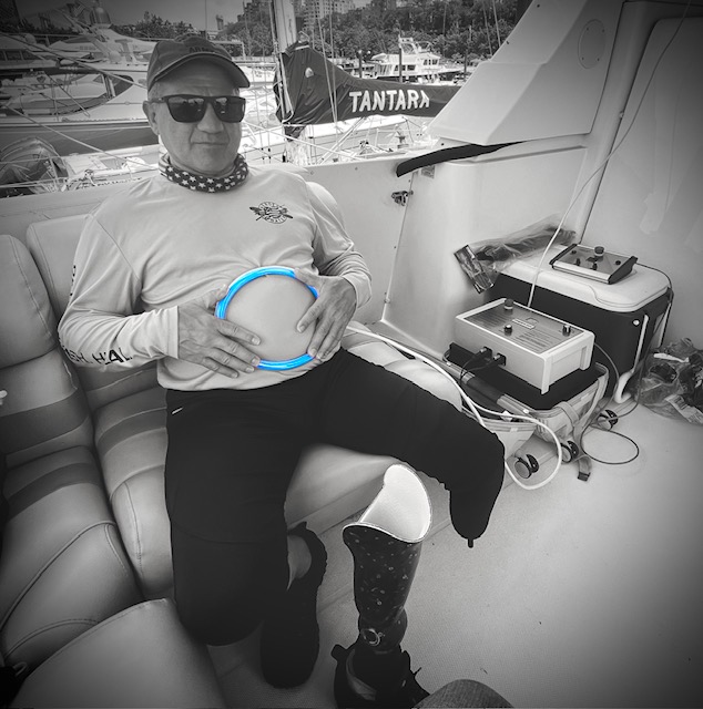 PEMF therapy coil applied to stomach area for digestive wellness